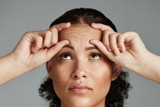 How To Get Rid Of Forehead Wrinkles Safely