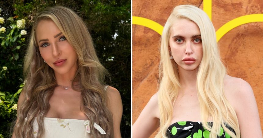 Alix Lynx Reacts to Euphoria Star Criticizing OnlyFans