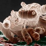 Antibiotics Can ‘Inflame’ Bacteria, Making Infections Harder to Treat : ScienceAlert