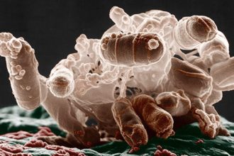 Antibiotics Can ‘Inflame’ Bacteria, Making Infections Harder to Treat : ScienceAlert