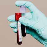 Blood Tests Could Reveal Alzheimer’s Risk Years Before Symptoms Appear : ScienceAlert