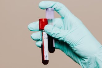 Blood Tests Could Reveal Alzheimer’s Risk Years Before Symptoms Appear : ScienceAlert