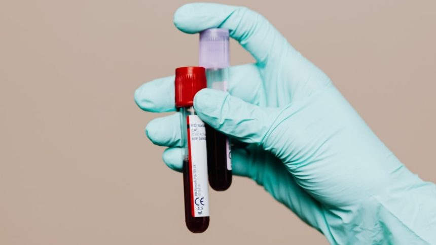 Blood Tests Could Reveal Alzheimer’s Risk Years Before Symptoms Appear : ScienceAlert