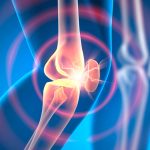 Experimental Drug Can Reverse Osteoarthritis in Weeks, Animal Research Shows : ScienceAlert