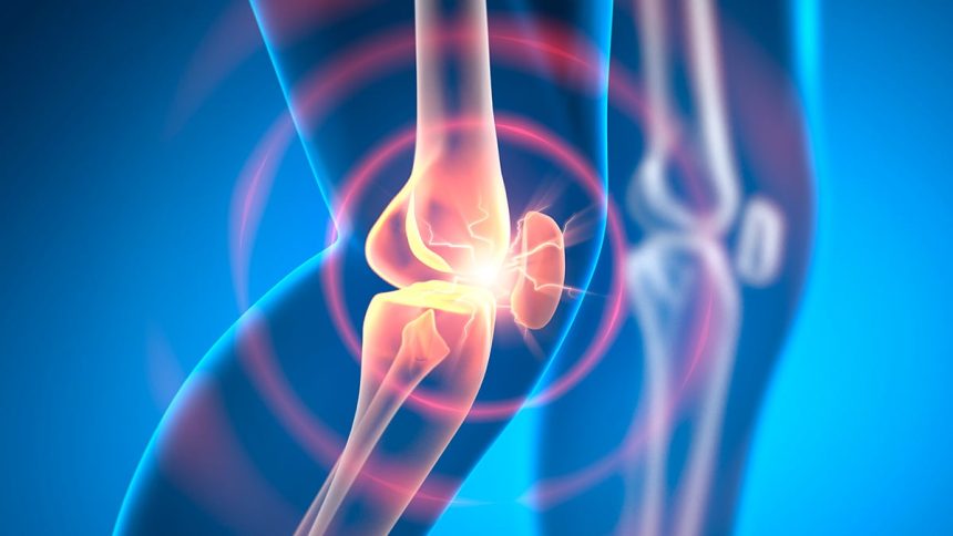 Experimental Drug Can Reverse Osteoarthritis in Weeks, Animal Research Shows : ScienceAlert