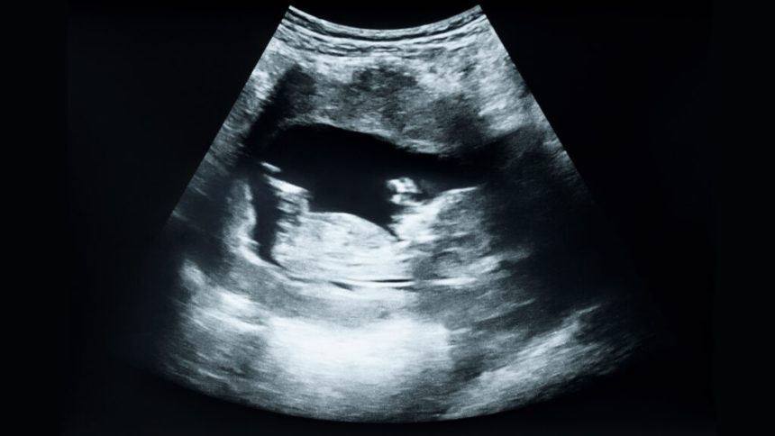 Iran war public health, C-section rates: Morning Rounds