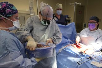 Novel approach to transplant rejection shows promise in new study