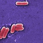 Raw dairy, e. coli, infant formula, food safety: Morning Rounds