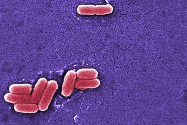 Raw dairy, e. coli, infant formula, food safety: Morning Rounds