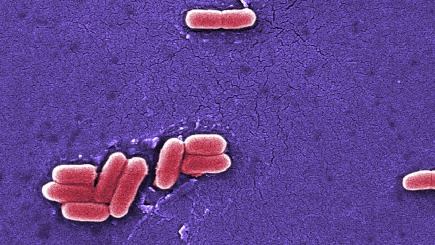 Raw dairy, e. coli, infant formula, food safety: Morning Rounds