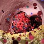 Simple treatment tweak drastically reduces blood loss from severe cuts