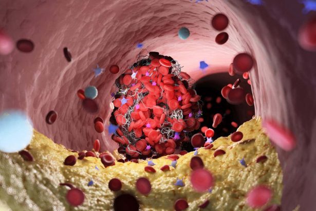 Simple treatment tweak drastically reduces blood loss from severe cuts