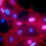 Study finds missed opportunities for targeted cancer treatments