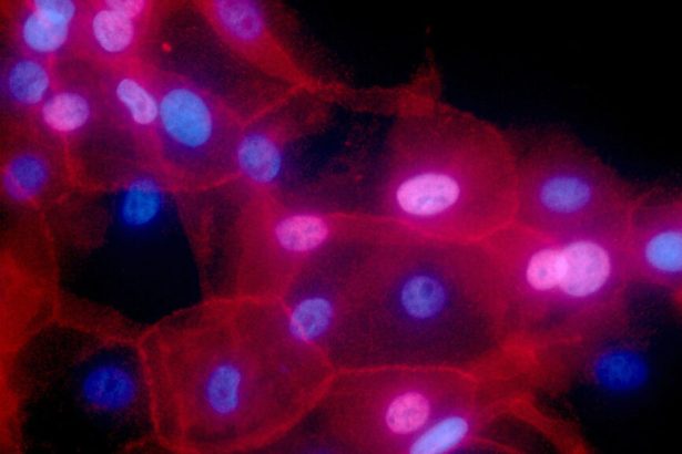 Study finds missed opportunities for targeted cancer treatments