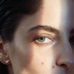 How to Treat Dark Circles, According to Dermatologists