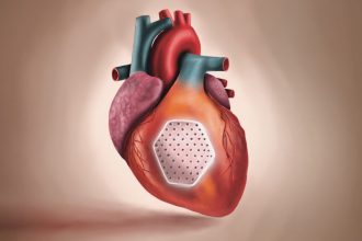 BioVAT stem cell heart patch offers hope for heart failure patients