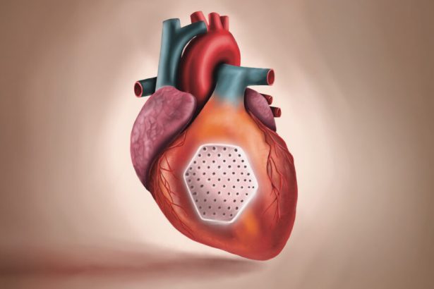 BioVAT stem cell heart patch offers hope for heart failure patients