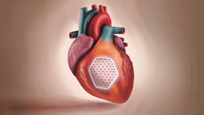 BioVAT stem cell heart patch offers hope for heart failure patients