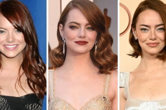 Emma Stone’s Transformation Revealed Amid Plastic Surgery Rumors