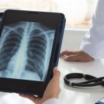 GLP-1 Weight Loss Drugs Could Stop Cancer Progressing, Says New Study
