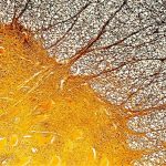 Immune Cell Discovery Might Explain Multiple Sclerosis at Its Worst : ScienceAlert