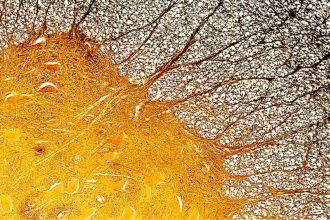 Immune Cell Discovery Might Explain Multiple Sclerosis at Its Worst : ScienceAlert