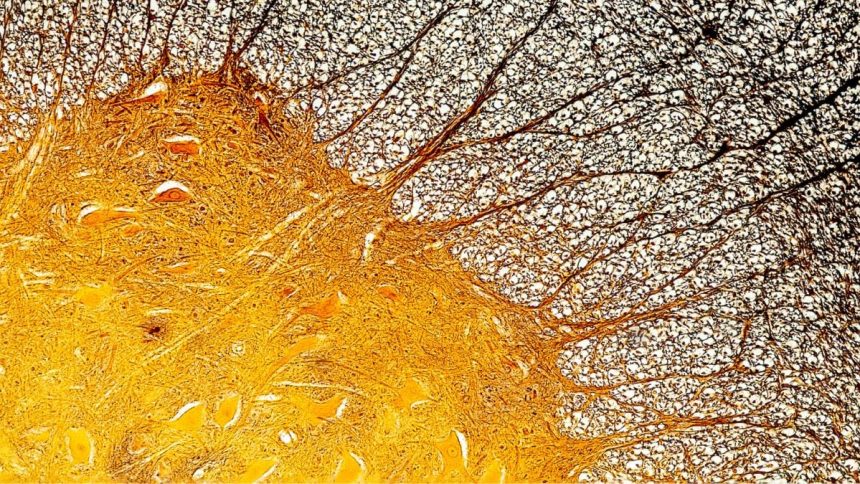 Immune Cell Discovery Might Explain Multiple Sclerosis at Its Worst : ScienceAlert