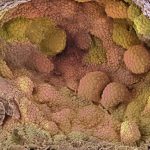New hormone protocol cut relapse risk in prostate cancer trial
