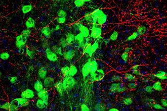 Tourette’s And OCD Overlap, And a Newly Discovered Brain Link May Explain Why : ScienceAlert