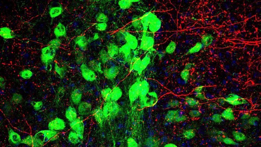 Tourette’s And OCD Overlap, And a Newly Discovered Brain Link May Explain Why : ScienceAlert