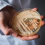 A Drug-Resistant Fungus Is Spreading Through American Hospitals