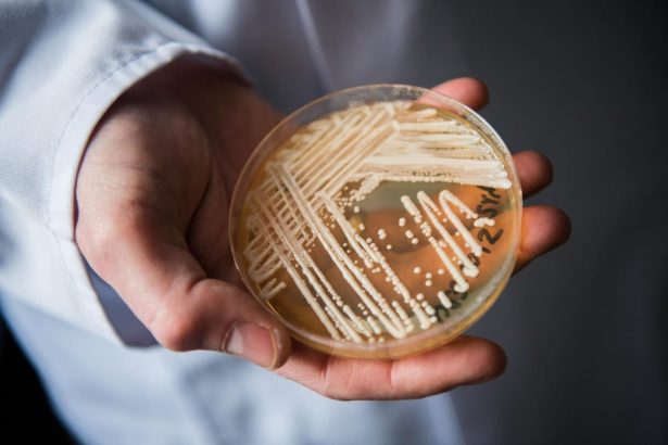 A Drug-Resistant Fungus Is Spreading Through American Hospitals