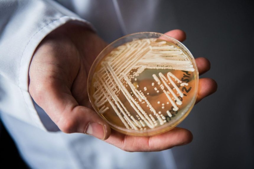 A Drug-Resistant Fungus Is Spreading Through American Hospitals