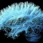 A Supplement For Joint Pain Could Accelerate Alzheimer’s Memory Loss : ScienceAlert