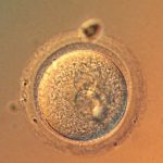 Are we getting to the point where it’s safe to gene-edit babies?