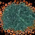 HIV, NIH, Ebola, gender care, puberty: Morning Rounds