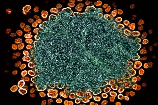 HIV, NIH, Ebola, gender care, puberty: Morning Rounds