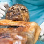 Ötzi the murdered Iceman’s microbiome is still active