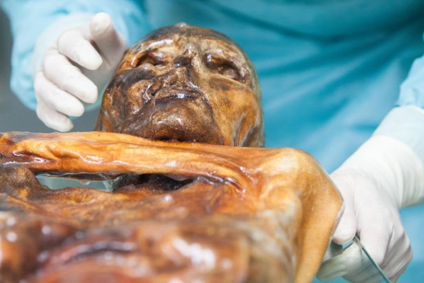 Ötzi the murdered Iceman’s microbiome is still active