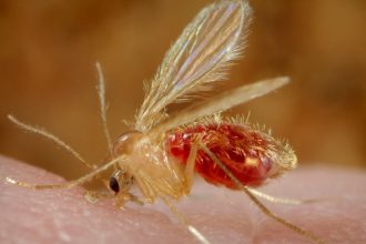 Parasites ‘Reawaken’ Woman’s Rare Birth Anomaly Decades Later : ScienceAlert