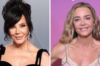 Radar Reveals the Most Shocking Celebrity Facelift Transformations