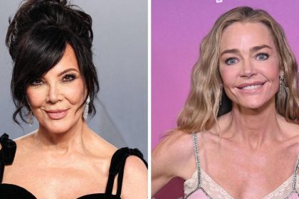 Radar Reveals the Most Shocking Celebrity Facelift Transformations