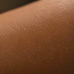 How to Get Fiberglass Out of Skin Safely Without Making It Worse