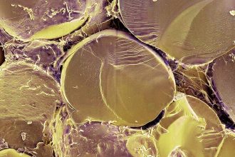 Crucial Fat Metabolism Switch Identified in Human Cells For First Time : ScienceAlert