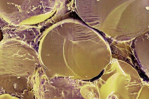 Crucial Fat Metabolism Switch Identified in Human Cells For First Time : ScienceAlert