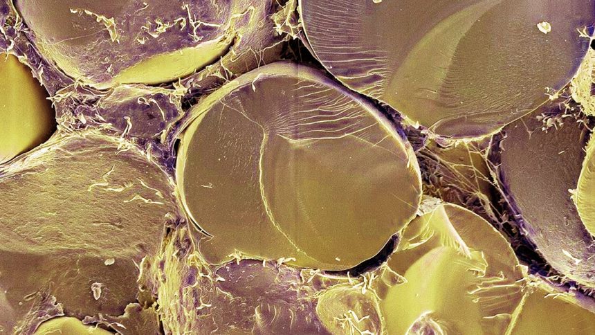 Crucial Fat Metabolism Switch Identified in Human Cells For First Time : ScienceAlert