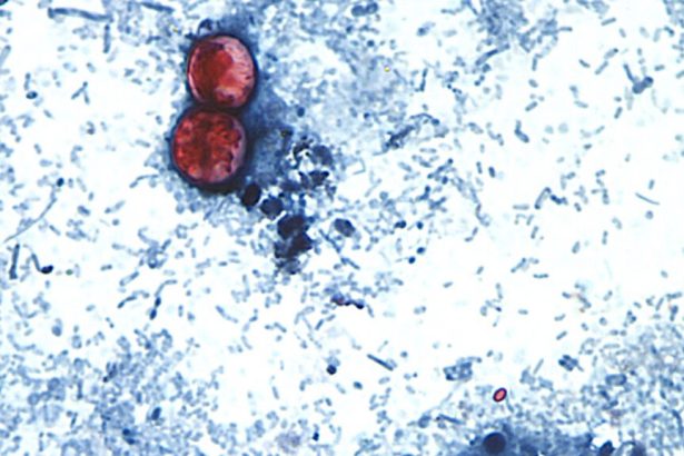 Cyclosporiasis outbreak cases surge to record levels