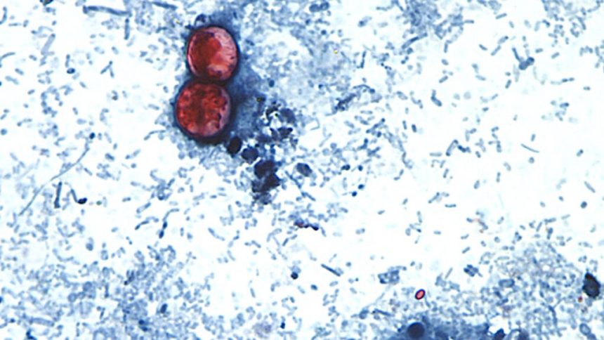 Cyclospora now in 29 states, more than 1,000 cases reported
