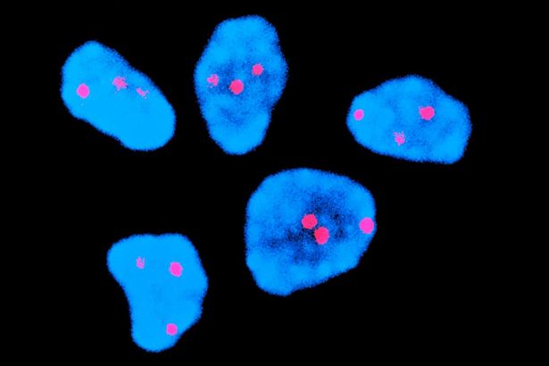 Injection halves risk of chromosome error common in older human eggs