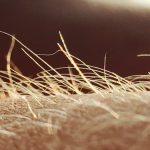 Itching May Have Its Own Sensory Organ : ScienceAlert